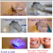 Dentech Home Tray Light Kit  16% CB - thumb 4
